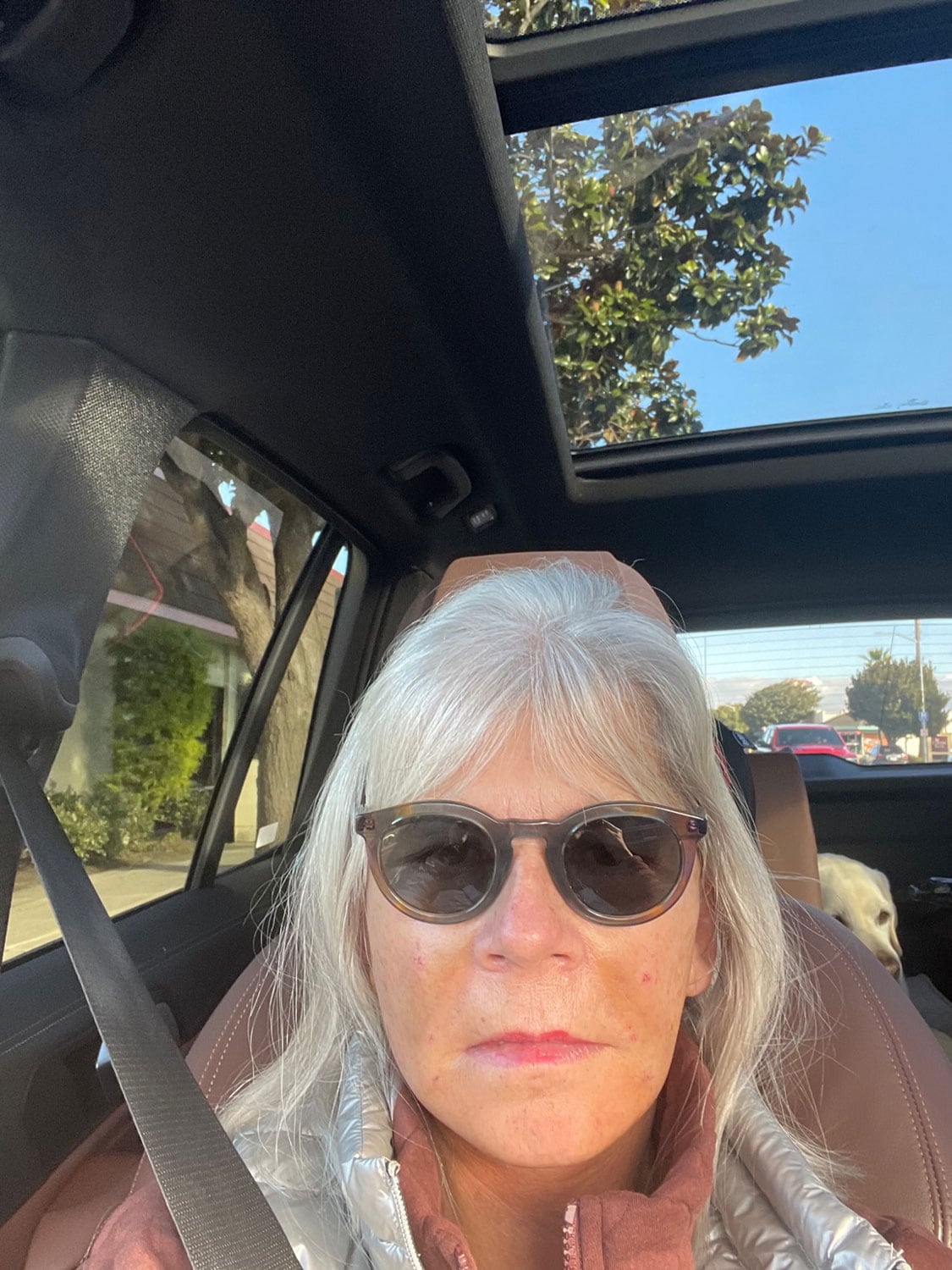 cindy hattersley facelift post op 3rd day