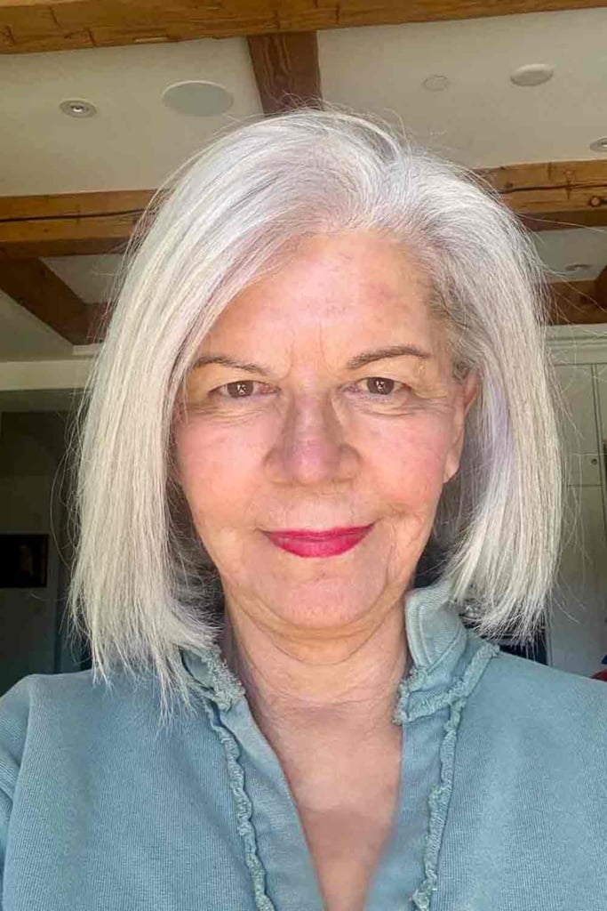 cindy hattersley tca chemical peel day 8