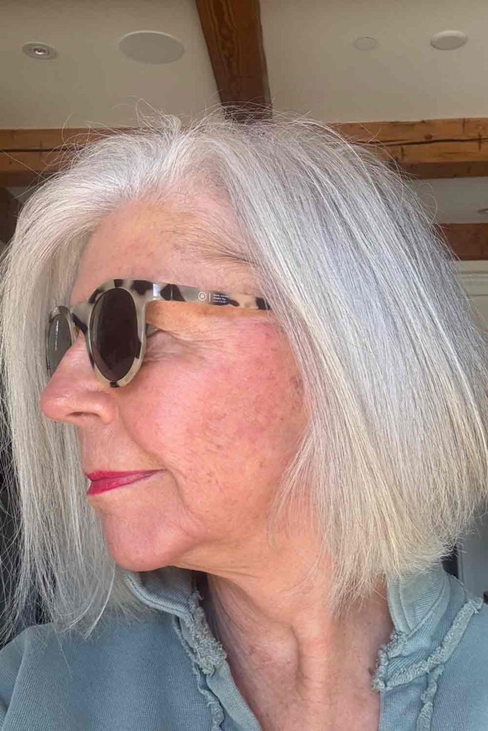 cindy hattersley post peel day 8